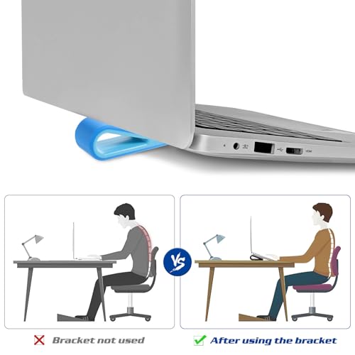 OSALADI 4pcs Laptop Cooling Stand Adjustable Height Notebook Riser for Desk Use, Blue and White Ventilated Holder for Enhanced Laptop Ventilation and Ergonomic Workspace