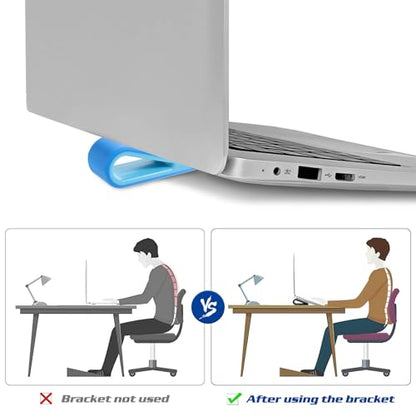 OSALADI 4pcs Laptop Cooling Stand Adjustable Height Notebook Riser for Desk Use, Blue and White Ventilated Holder for Enhanced Laptop Ventilation and Ergonomic Workspace